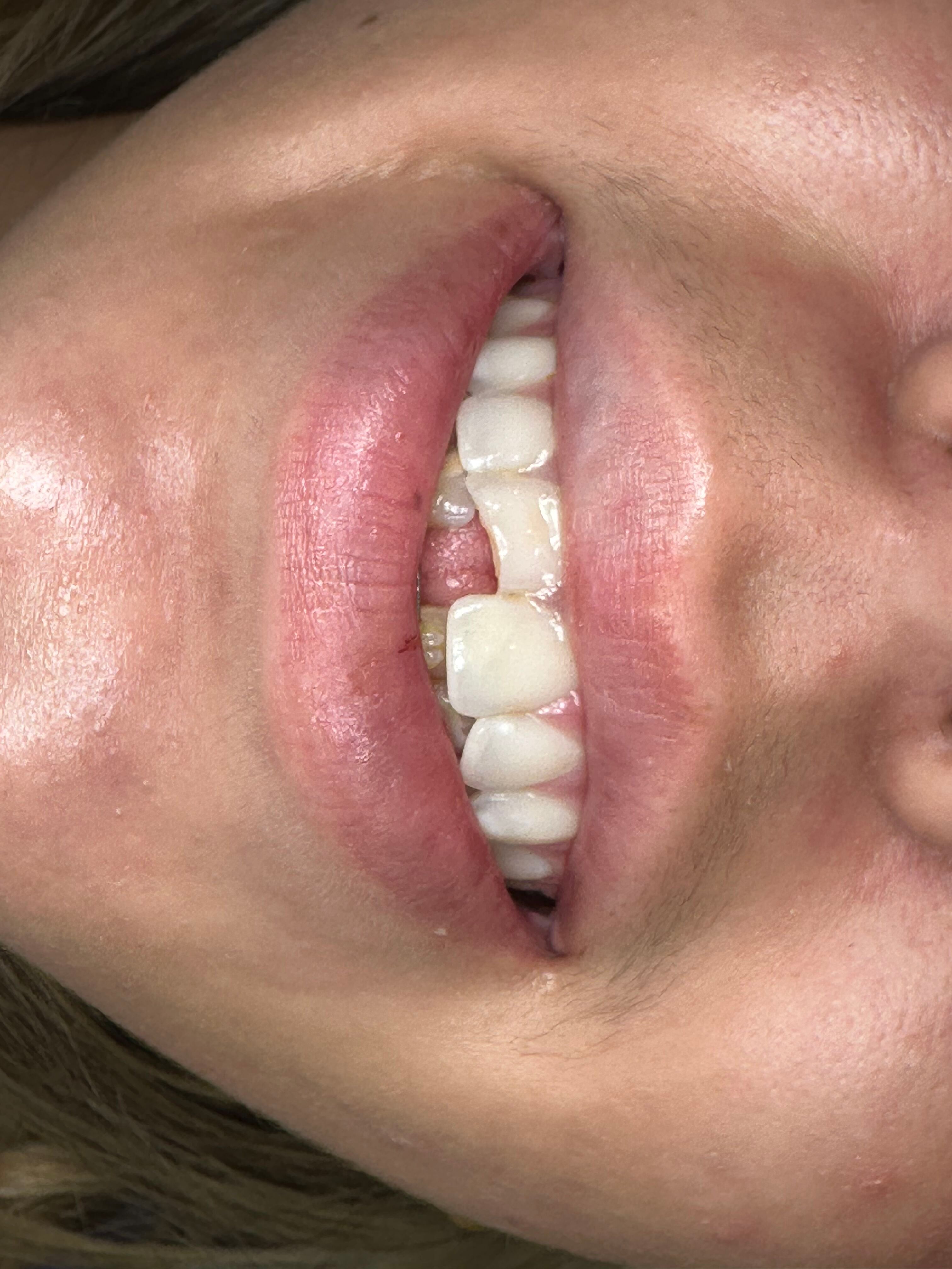 Before emergency dental treatment